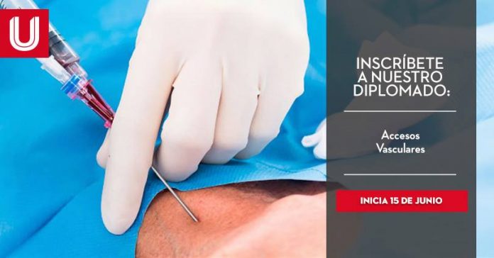 Diplomado en Accesos Vasculares